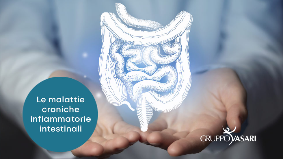 Malattie Infiammatorie Croniche Intestinali Gastroenterologo Grosset